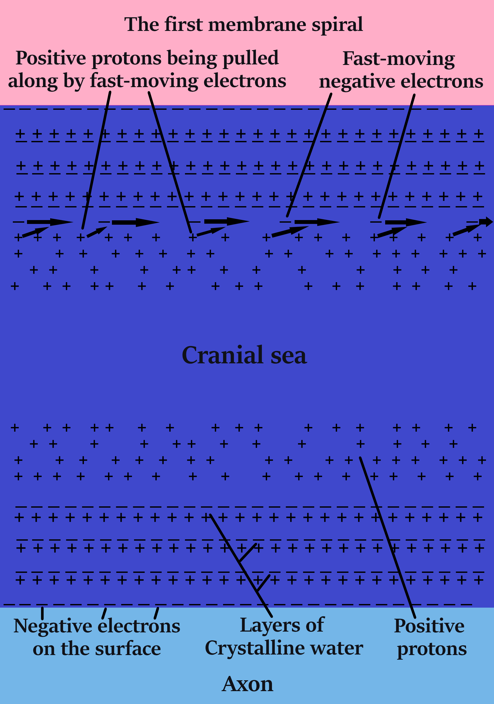 axon pump extra 11 c