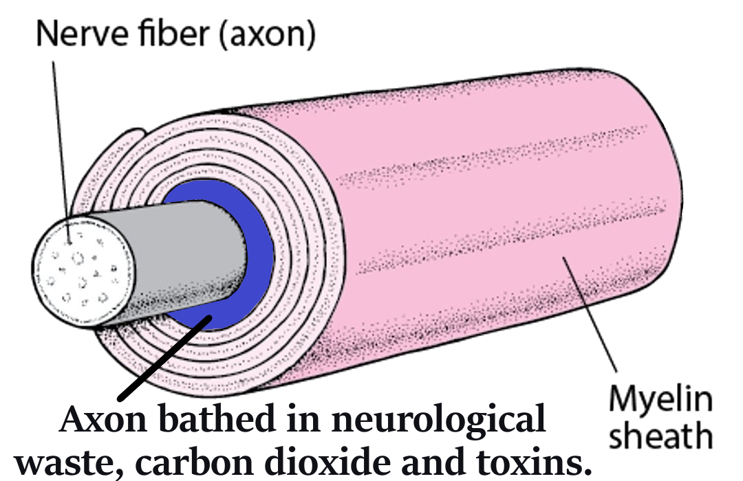 myel 2edit clear 3a b