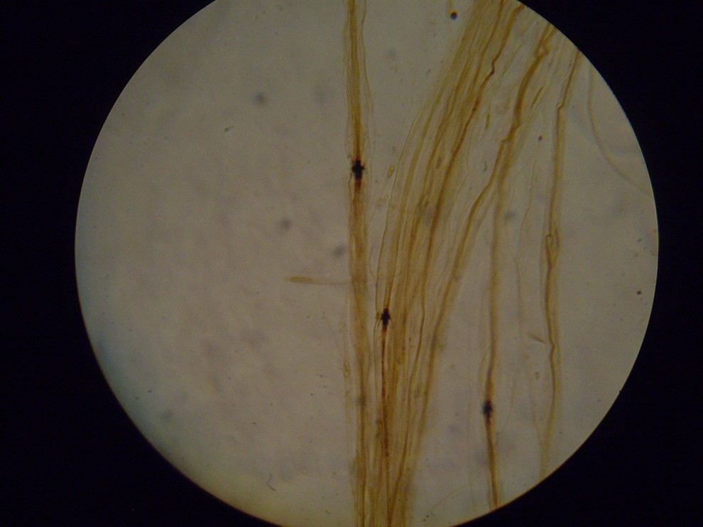 myelin Przewężenie Ranviera 990